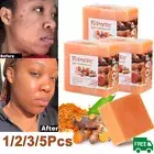 1-3× Tumeric Soap Skin Whitening Dark Spots lightening Acne Brightening Turmeric