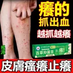 草本止癢軟膏【無效全額退費】濕疹止癢膏蕁麻疹乳膏私處瘙癢消炎軟膏蚊蟲叮咬止癢消腫過敏性季節性抗菌膏舒緩涼感皮膚瘙癢修復霜