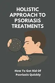 Holistic Approach To Psoriasis Treatments: How To Get Rid Of Psoriasis Quickly: Is Psoriasis Itchy
