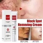 Dark Spots Corrector Whitening Blemish Cream Removal Freckle Cream Skin Care 20g