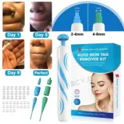 Hot Skin Tag Remover Tool Kit Wart Spot Remover Mole Remover Skin Care Band New