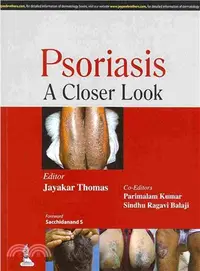 在飛比找三民網路書店優惠-Psoriasis ― A Closer Look