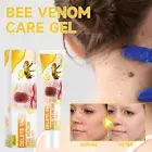 Bee Venom Wart & Tag Remover Cream Neck Body Skin Health Care Gel Women Men 20g^