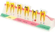 iplusmile Teeth Model for Teaching and Study Pathological Tooth Model for Education for Patient Demonstration and Understanding Decay