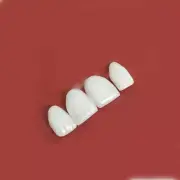 3Pcs Dental Tooth Veneers Whitening Ceramic Upper Teeth Veneer Bright L M S