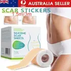 Silicone Scar Sheets Gel Tape 3m Roll Scars Removal Skin Treatment Patch Tapes