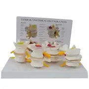 Four Stage Vertebrae Model, Human Anatomy and Physiology Educational Spine Model, Doctor'S Office Anatomy Model as shown
