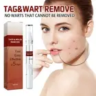 SAFE SKIN TAG REMOVER PEN MOLE WART ACNE LIQUID PIMPLE PATCH REMOVAL SPOT