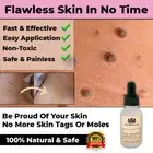 NEW SAFE SKIN TAG REMOVER OIL MOLE WART ACNE LIQUID PIMPLE PATCH REMOVAL SPOT