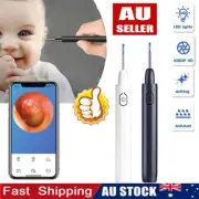 Ear Wax Remover Pick LED Light Scoop Tool Camera Cleaning Ear Cleaner Removal KJ