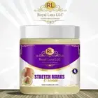 Stretch Marks Cream