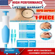 Auto Micro Skin Tag Remover Device Kit Safe Painless Removal 2-8 mm Band Tool