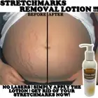 FADE AWAY STRETCH MARK LOTION CREAM MAX STRENGTH REMOVES STRETCH MARKS