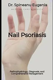 Nail Psoriasis: Pathophysiology, Diagnosis, and Comprehensive Management