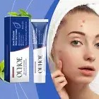 Herbal Acne Treatment Cream Gentle Soothing Hydrating Oil Control For Clear Skin