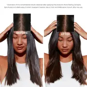 Kérastase Symbiose Most Loved Coffret for Anti-Dandruff