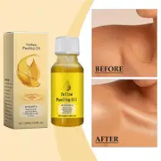 Yellow Exfoliating Oil Peeling Dead Skin Oil Finger Elbows Knees 50ml A