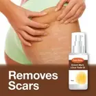 FADE AWAY STRETCH MARK & SCAR FADE OIL – FAST WORKING PREVENTS STRETCH MARKS