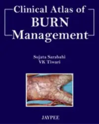 在飛比找博客來優惠-Clinical Atlas of Burn Managem