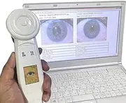 HD iris Camera, iris Analyzer, iridology Camera with 30x HD iris Lens, 2-Million Pixel Computer Type iris Detector, Left and Right Illumination Switch, iris Magnifier