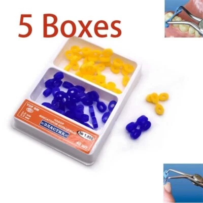 5X Dental Sectional Contoured Matrix Matrices Elastic Fixing Wedges Rubber Dam