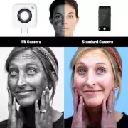 UV Camera for iPhone 15 Smartphone Visible Facial Sunscreen Protection Hots