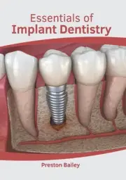 Essentials of Implant Dentistry by Preston Bailey (English) Hardcover Book
