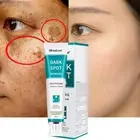 20ML Whitening Freckle Cream Remove Dark Spots Anti-Freckle Cream Fade