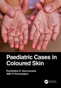 在飛比找博客來優惠-Paediatric Cases in Coloured S