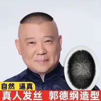 在飛比找蝦皮商城精選優惠-【現貨秒發】生物頭皮男士假髮片郭德綱髮型工廠批發光頭男假髮真