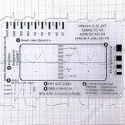 ECG 7 Step Ruler, ECG Calipers Pocket Ruler, ECG Ruler Plastic Ruler Measuring Tool, ECG Reference Guide, EKG Ruler Horizontal Badge Card Tool, Easy-to-Carry ECG Ruler, Follow a 7 Step Plan afeamo