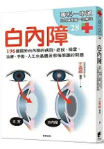 白內障：196篇關於白內障的病因、症狀、檢查、治療、手術、人工水晶體以及術後照護的問題