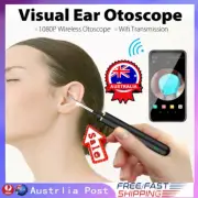 1080P Wireless Ear Cleaner Scoop Endoscope Camera Pick Otoscope Ear Wax RemoveAN