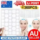 36Pcs Dermopatchy Acne Skin Tag Pimple Remover Patch Removal Facial Care Spot AU