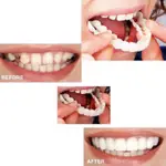 優選仿真假牙覆蓋假牙護理創意牙齒臨時防真假牙套 BEAUTIFUL SMILE5.5G