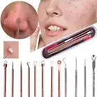 4x Blackhead Remover Tool Kit Pimple Remover Acne Needle Blackhead Tweezers