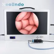 Full HD Endoscope Camera With 24 Inch Monitor 80W LED Light Source With Recorder