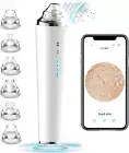 Blackhead Remover Pore Vacuum with Camera, Black Head Remover Suctioner 3 Suc...