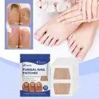Toenail Fungus Extra Strength 8-Hour Nighttime Renewal Toenail Fungus Nice :з