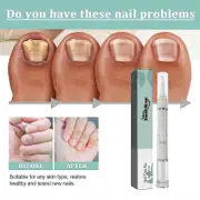 South Moon Nail Repair Pen for removing dead skin and barbed gray nails, nourishing and nourishing nail repair pen -GBN | 9415667426079