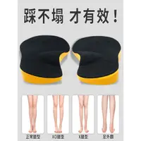 在飛比找ETMall東森購物網優惠-日本o型腿內外八字腳矯正鞋墊
