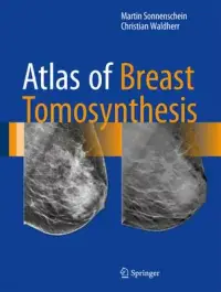 在飛比找博客來優惠-Atlas of Breast Tomosynthesis: