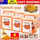 6PCS Turmeric Whitening Brightening Soap - Dark Spot Lightening & Acne Treatment