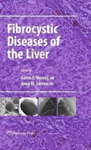 Fibrocystic Diseases of the Liver by Karen F. Murray (English) Paperback Book