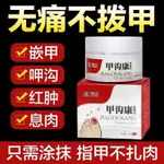 【原裝速發】現貨 甲 溝康 保健 膏治 甲溝 炎嵌 甲紅 腫疼 痛消 肉芽 化膿 走路 指甲 扎肉