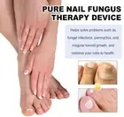 For Fungal Nail Purenail Fungus Laser Therapy Device Light Therapy Device J