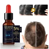 在飛比找Yahoo!奇摩拍賣優惠-熱賣 買2送1 生薑王頭髮營養液養育頭髮根防止脫落控油5%M