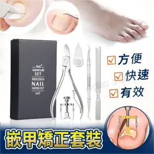 凍甲神器套裝組 卷甲蓋工具 修腳工具 凍甲的剋星 甲溝炎 修腳刀 灰指甲 死皮剪 凍甲矯正器套組