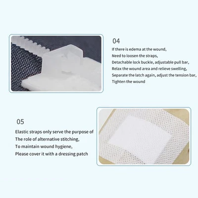 Zipper Band-aid Painless Wound Closure Device Patch Zip Suture Reducer Band