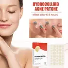 Pimple Patches Skin Tag Remover Patch Acne Spot Treatment Hydrocolloid Master